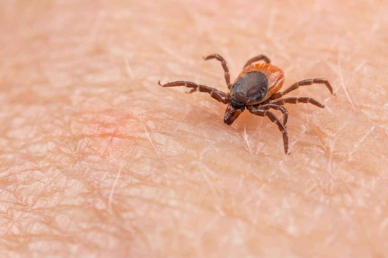Picture of a tick on skin