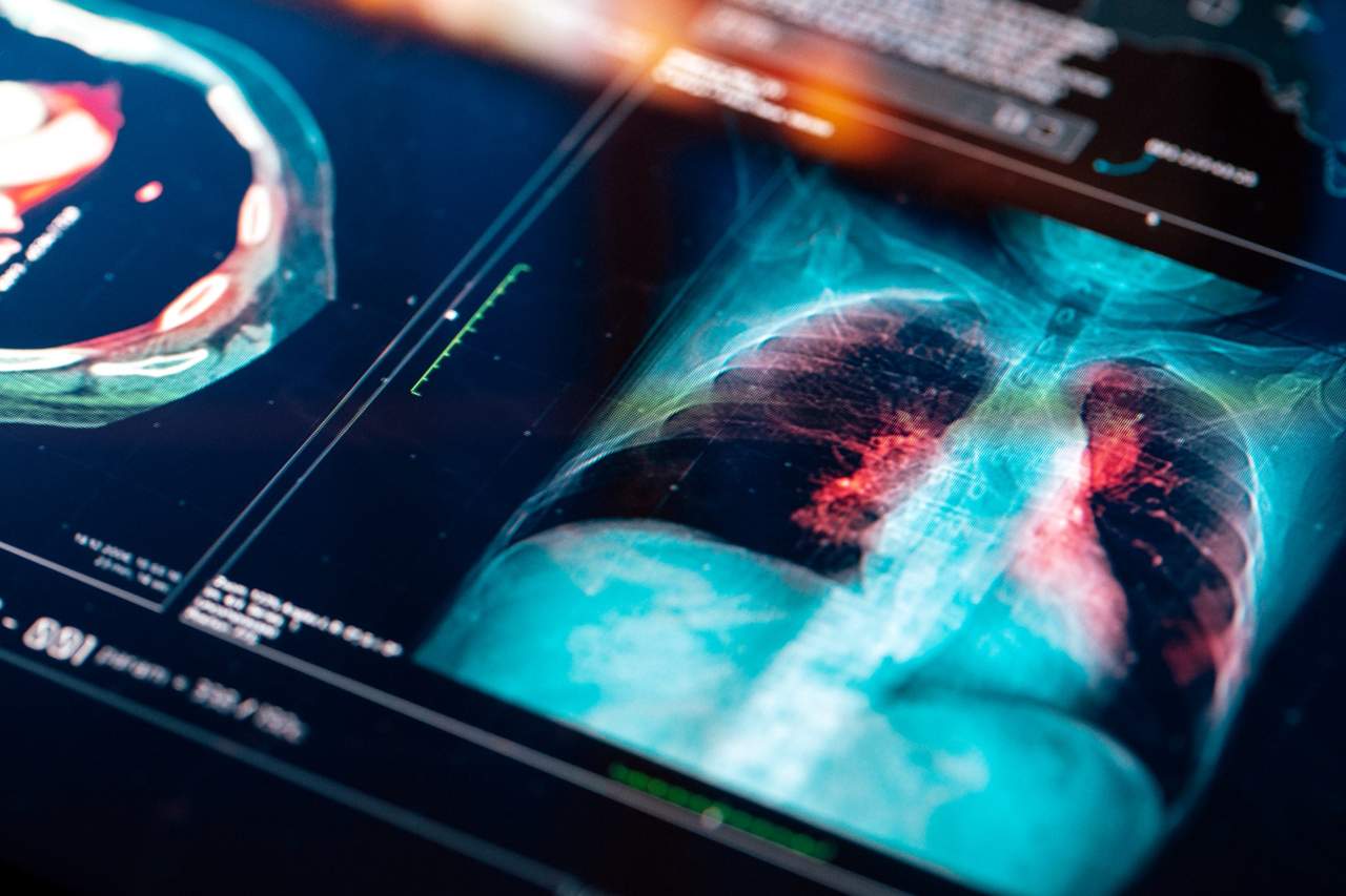 Medical imaging display showing a chest scan