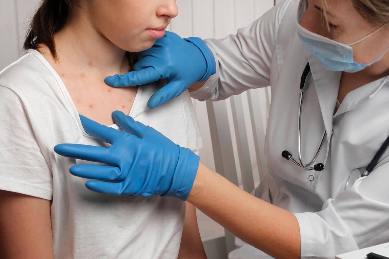 What Are Measles? | Baptist Health