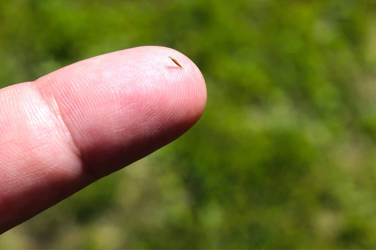 Close up of a finger with a splinter