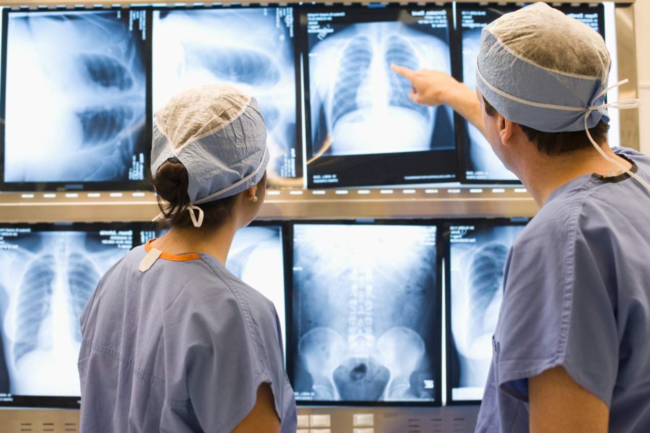 Doctors Reviewing X rays