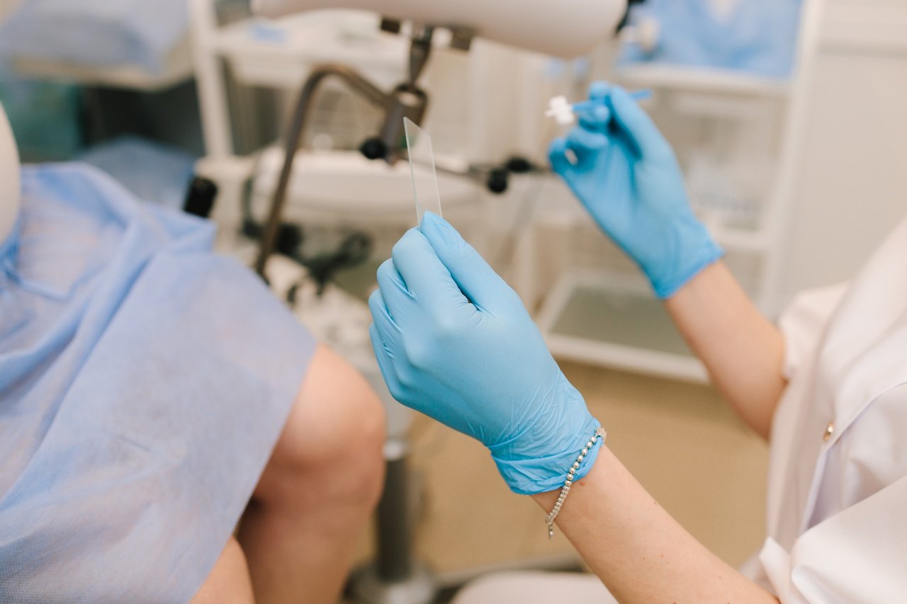 pap smear preparation