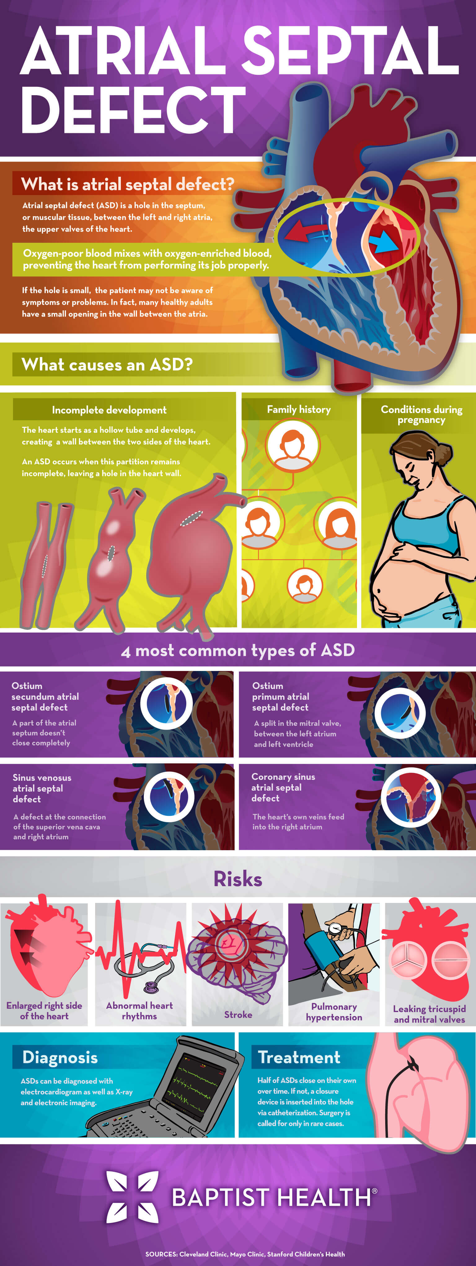 atrial septal defect infographic