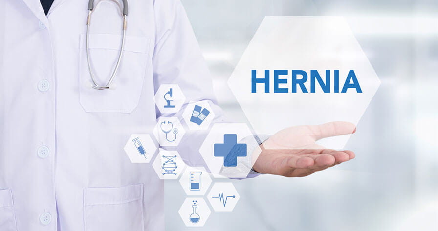 Hernias-Common-Types